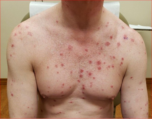 買可樂約炮交友性病1