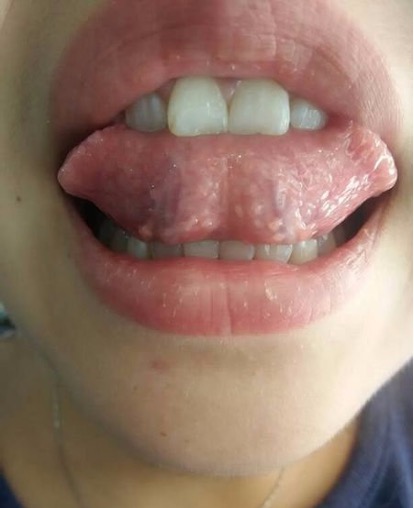 買可樂約炮性病3